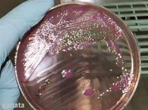 Environmental health officers deal with nursery school E. coli outbreak 